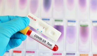 Após pressão do Min. Saúde, Anvisa libera a venda de autotestes para o Covid-19