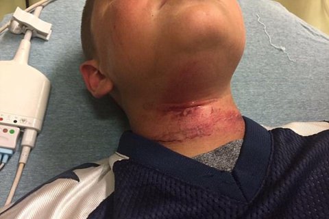 Garoto de 8 anos sofre tentativa de enforcamento em ataque racista nos EUA